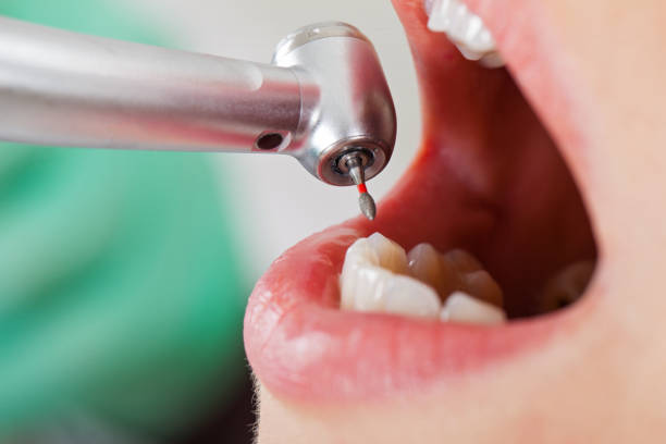 Best Weekend Emergency Dentist in Slater, MO